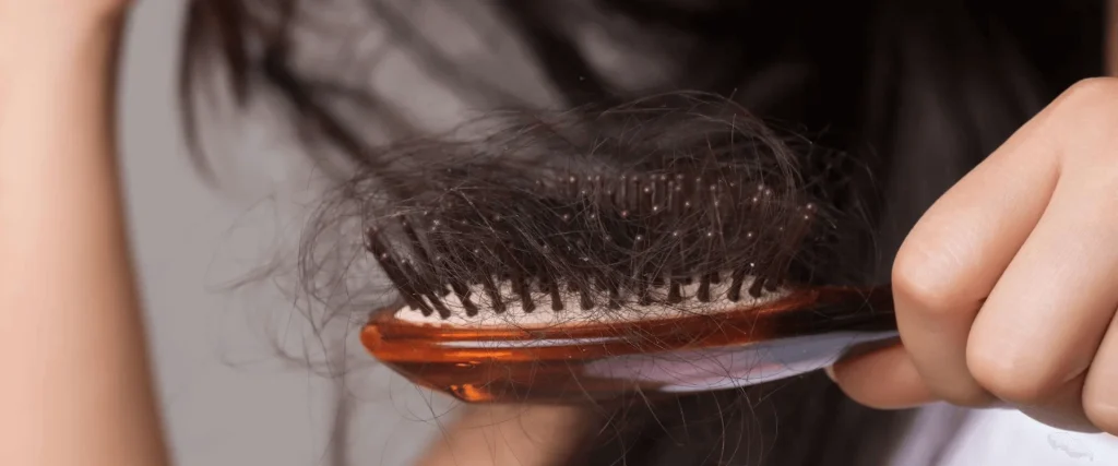 a brush with an abundance of hair, indicating excessive shedding